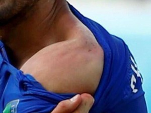 Suarez dà un morso a Chiellini e rischia la squalifica con prova tv (video/foto).