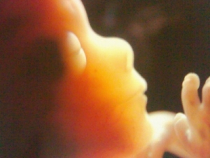 Twitter, aborto online: RU486 per interrompere gravidanza, diario giornaliero.