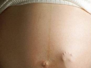 Salute: gravidanza non rovina cervello delle donne, mito sfatato