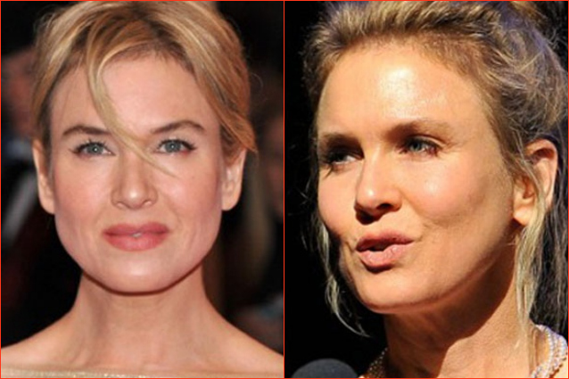 Renée Zellweger trasformata dalla chirurgia in pochi mesi (FOTO).