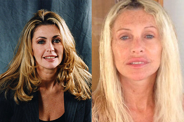 Paola Ferrari operata al viso, il suo volto ieri e oggi.