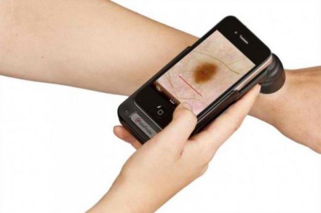 Diagnosticare il cancro: c'è un app anche per questo?