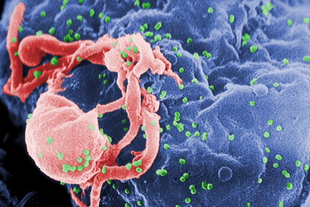 Scienziati annunciano due scoperte decisive contro l'HIV.