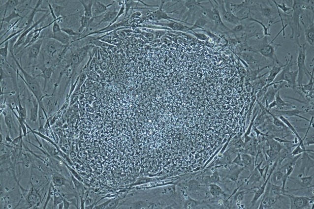 L-Prolina, ecco il motore delle cellule staminali.