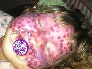 La crema da pigmentary nota su una faccia una pelle