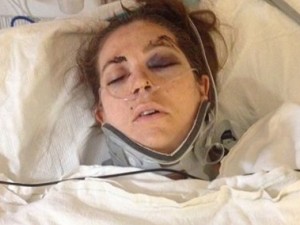 Donna incinta picchiata a sangue durante videochiamata con il marito.