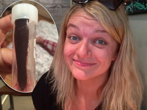 Perde dal sangue dal naso per un mese: aveva una sanguisuga nella narice.