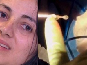 Soffre di mal di testa e incubi: all'interno del suo cervello c'era un parassita