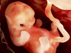 Bimbo di 4 anni nasce 'incinto': il nuovo caso di fetus in fetu