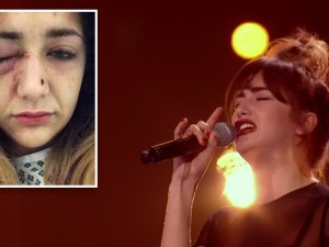 L'ex concorrente di X Factor aggredita dal fidanzato: il ragazzo sar? condannato