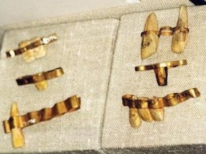 Siena, operaio ruba denti d'oro a un defunto durante riesumazione della salma