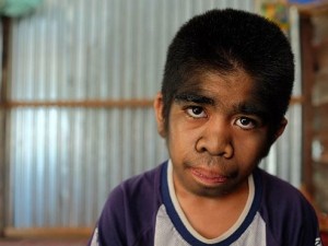 A 13 anni ? affetto da licantropia: ma nel suo villaggio lo venerano come un Dio