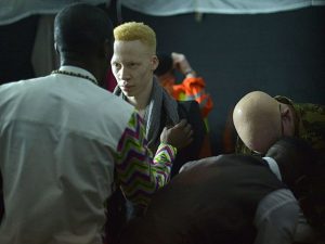 Albino in Nigeria, Africa (Getty). 