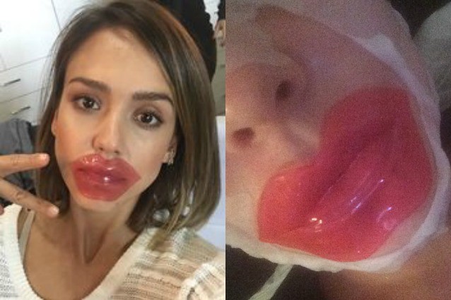 Maschera per le labbra: ecco l'ultima mania beauty delle star (FOTO)
