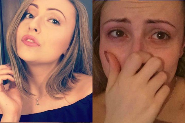 Scatta un selfie prima e dopo l?attacco di panico, cos? Amber mostra che cos?? l?ansia