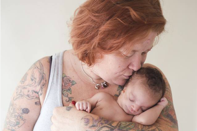 Nasce deformata, la famiglia adottiva l'abbandona: ora ? la vera mamma ad occuparsi di lei