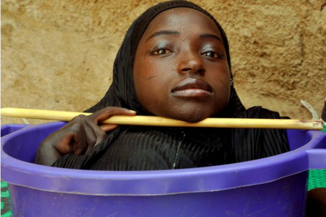 Rahma, la ragazza con gli arti sottosviluppati costretta a vivere in una bacinella