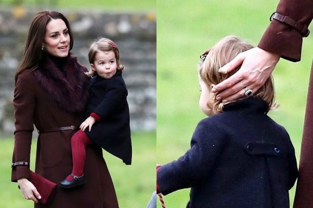 Kate Middleton e gli strani cerotti sulle mani