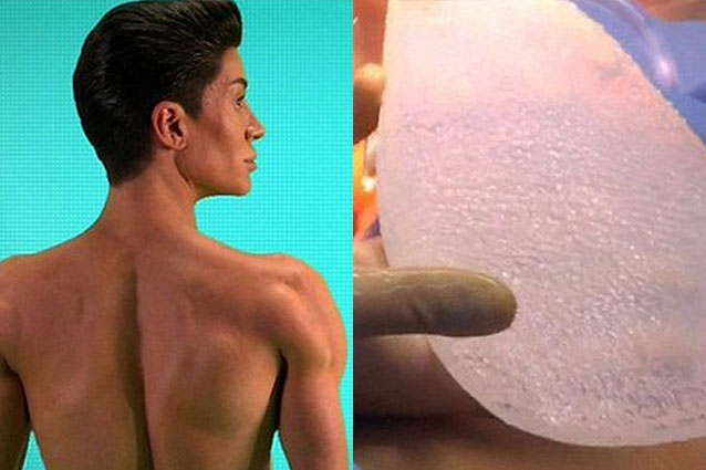 Leliminazione laser di pigmentary nota su una faccia Volgograd