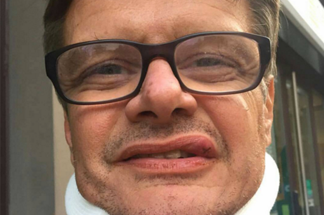 Aristide Malnati picchiato in un bar a Milano: 