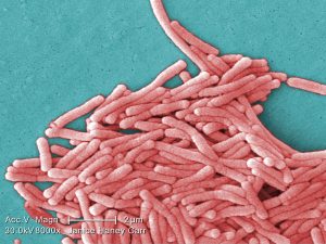 Allarme Legionella a Roma, turista infettato: chiuso un noto hotel in zona Cavour