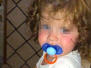 Addio alla piccola Irene, non ce l'ha fatta la bimba malata di cuore