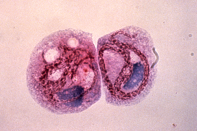 Batterio Legionella pneumophila: cos'? e come si cura la legionellosi