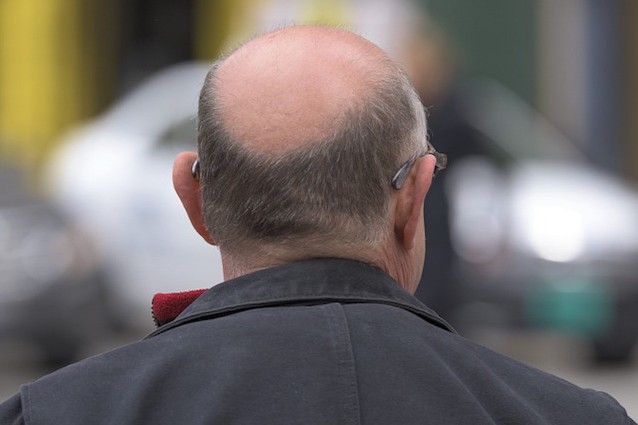 Perché i capelli una malattia abbandonano