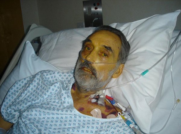 josh ryan evans causa de muerte george best mor 236 per un overdose di farmaci immunosoppressori josh ryan evans causa de muerte george best mor 236 per un overdose di farmaci immunosoppressori
