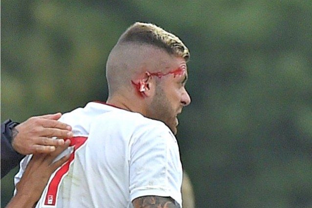 Menez costretto a uscire dal campo, il francese ha perso parte dell'orecchio