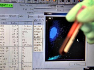 una provetta dell'antidoping