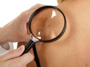 Controllo dermatologico nei