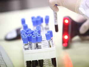 Un esame del sangue nel primo anno di età può rilevare l'autismo di un bambino
