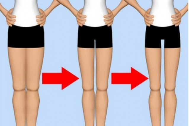 "Thigh Gap", la nuova ossessione delle adolescenti