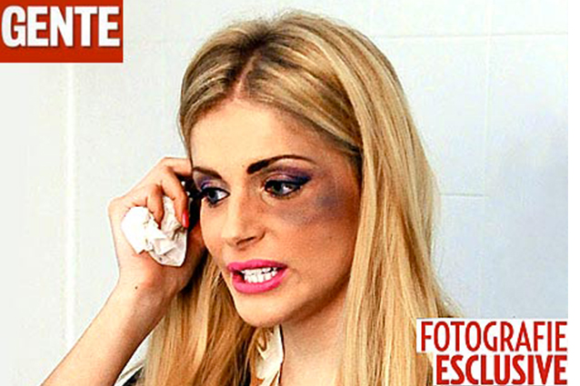 Ecco i lividi dello scontro che la soubrette avrebbe avuto con Lele Mora, le pubblica il settimanale Gente in esclusiva. Ma intanto l'ex agente dei vip nega ogni coinvolgimento.