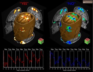 neuroimaging