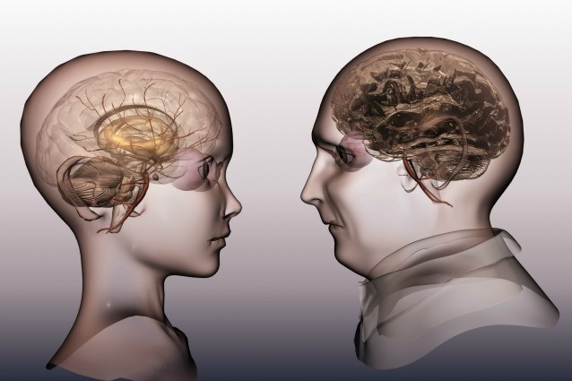 Alzheimer, individuati nuovi geni associati alla malattia