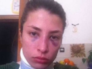 Jessica, picchiata dall'ex ragazzo, posta le foto su fb: "Ecco come mi ha ridotta"