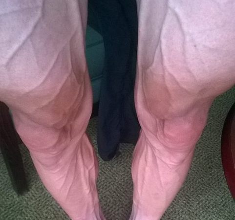 Bartosz Huzarski, e la foto delle sue gambe che sta facendo discutere il web