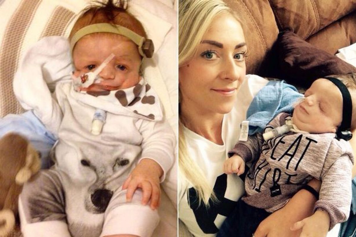 Sindrome Di Treacher Collins Aspettative Di Vita