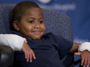 In Usa doppio trapianto di mani riuscito in un bambino di 8 anni