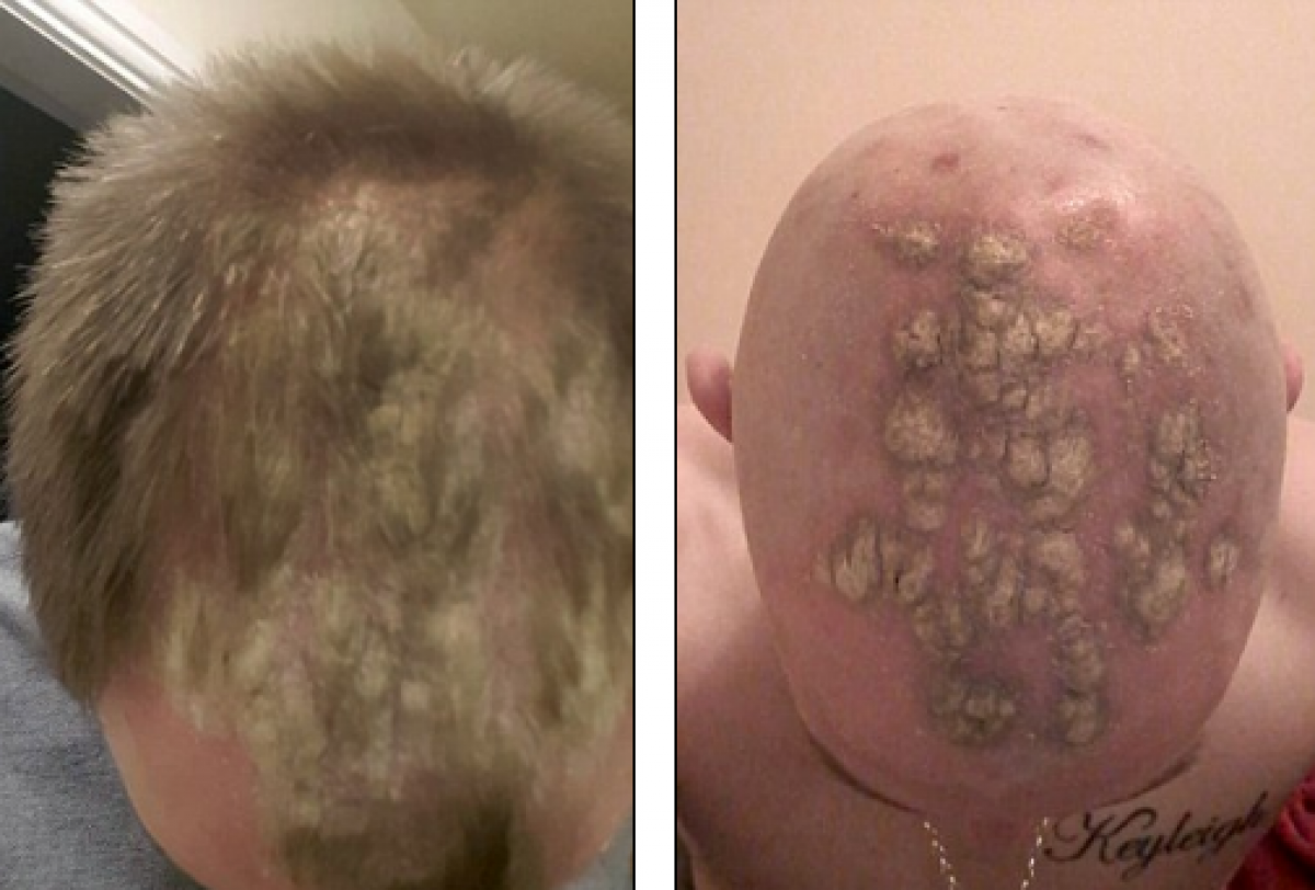 La Cera Fa Cadere I Capelli