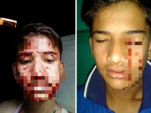 Il bambino che piange sangue dieci volte al giorno. Il padre: "Soffre di una rara patologia, aiutatemi"