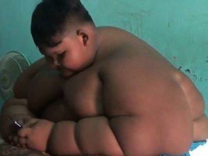 Indonesia, bimbo di 10 anni pesa 180 chili: mangia 5 barattoli di spaghetti al giorno