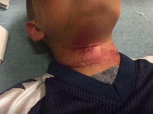 Usa: bimbo di 8 anni appeso ad un albero con la corda al collo da alcuni adolescenti