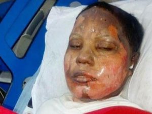 Pakistan: morta Asima, arsa viva dal fidanzato perché non voleva convertirsi all’Islam