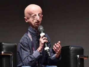 La grande forza di Sammy Basso:”Grazie alla progeria sto diventando ricercatore”