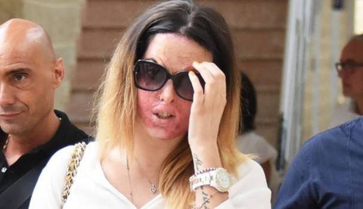 Gessica Notaro, l'ex fidanzato condannato a 15 anni e 5 mesi per l'aggressione con l'acido