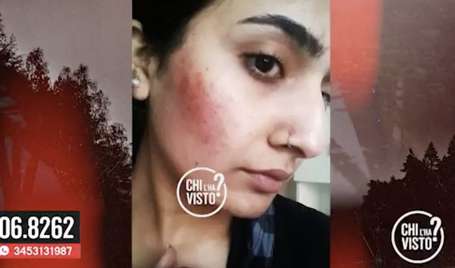 Saman Abbas e quel livido nella foto inviata al fidanzato: È stato mio cugino, ma lui smentisce - Vimarsana News