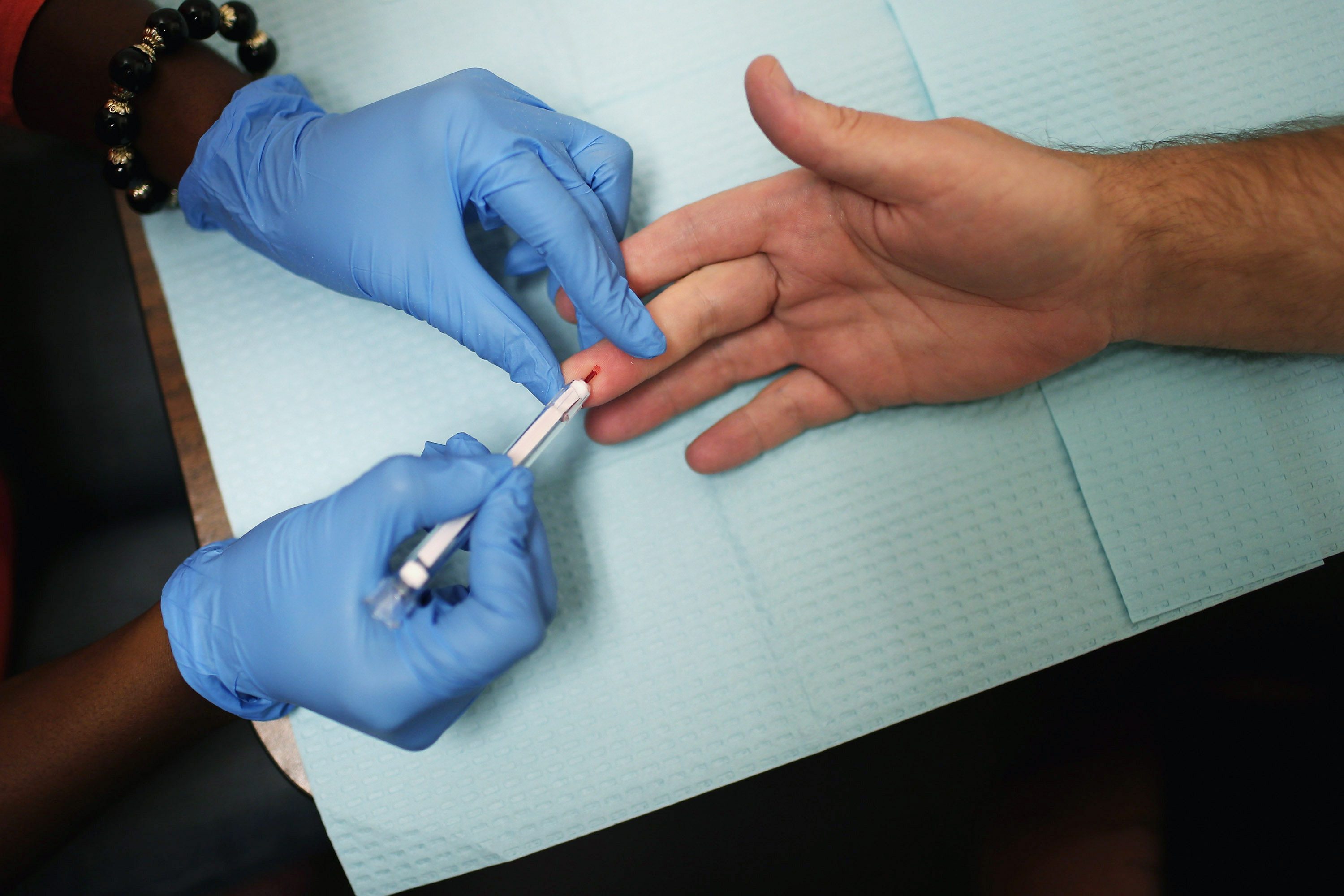 Giornata Mondiale Aids Oms Ecdc A Causa Del Covid Diagnosticati Il 24 